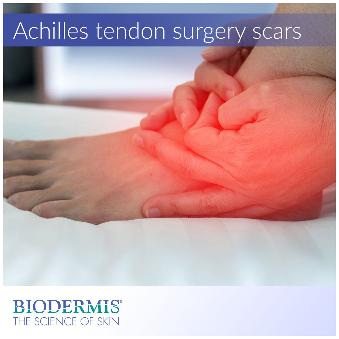 Achilles Tendon Surgery Scar Care  |  Biodermis.com Biodermis