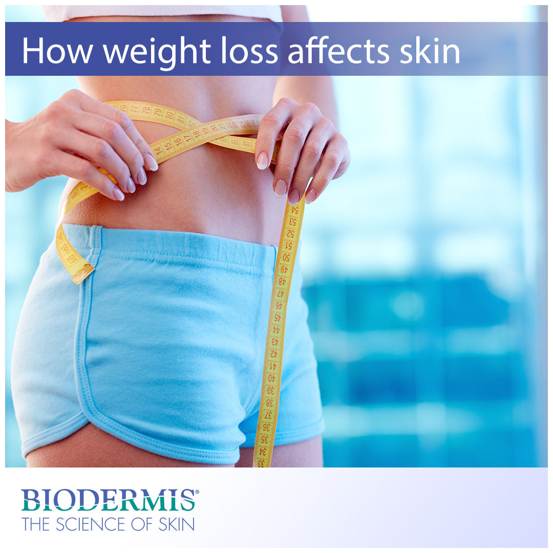 How Does Weight Loss Affect the Skin? |  Biodermis.com Biodermis
