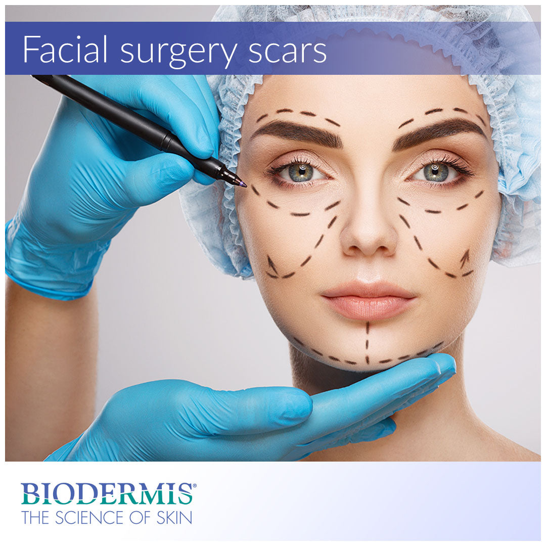 How to Treat Scars After Facial Surgery |  Biodermis.com Biodermis