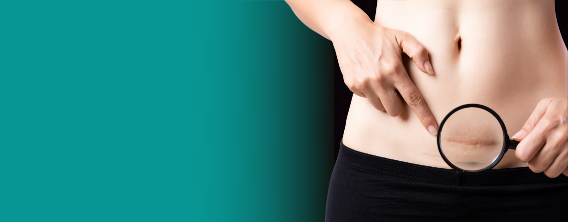 How to Heal Wounds Faster: A Comprehensive Guide