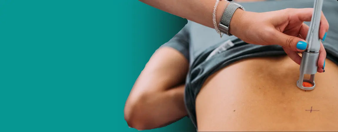 Laser Treatment for Scars: Everything You Need to Know – Biodermis