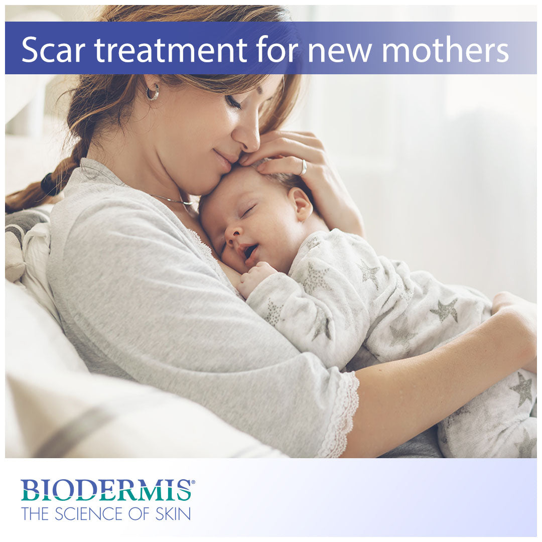 Scar Treatment for New Mothers |  Biodermis.com Biodermis