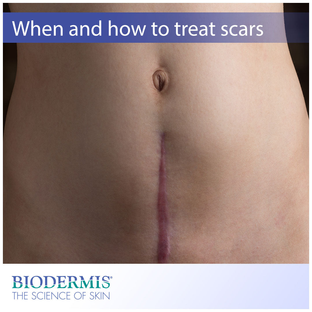 How to Get Rid of Surgical Scars? - New Image Beauty Bar