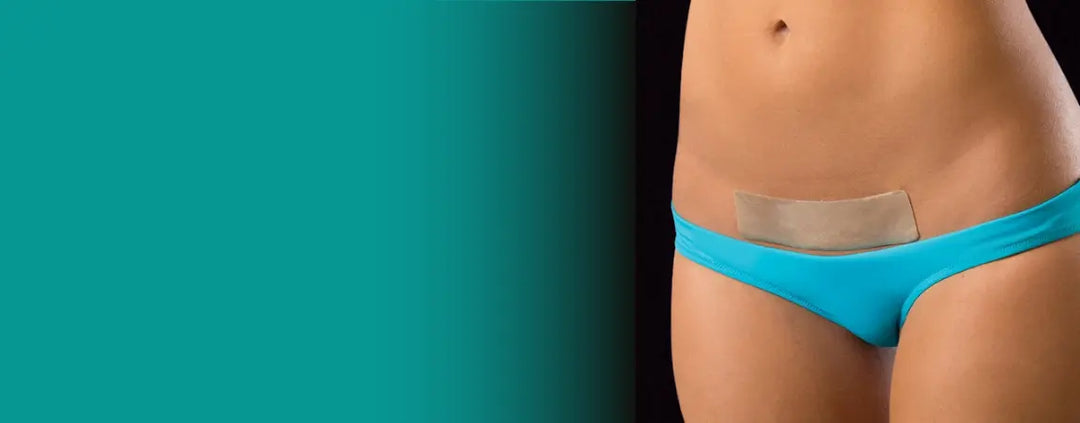 Silicone Scar Sheets: They Actually Work for Healing Scars