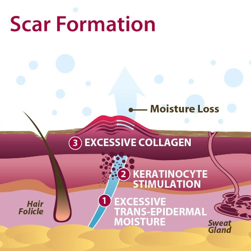 Epi-Derm C-Strip Biodermis