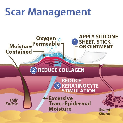 Epi-Derm C-Strip Biodermis