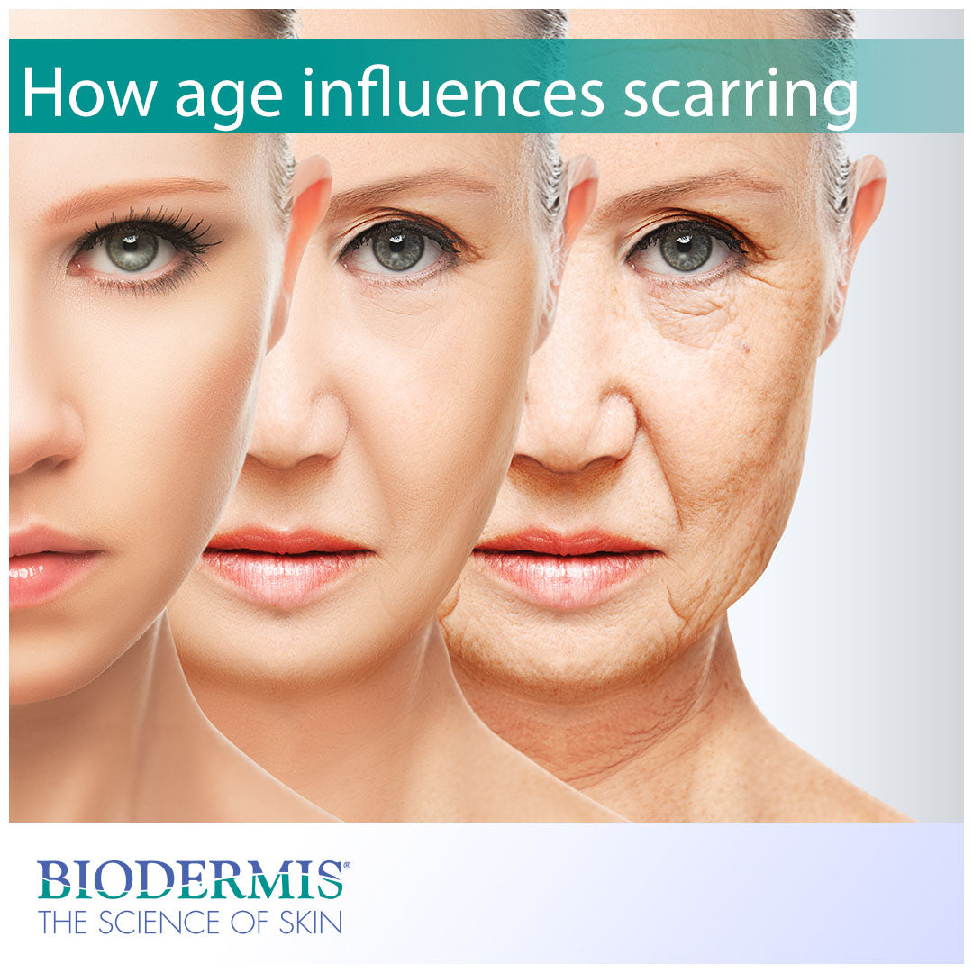 At What Age Are You Most Prone to Scarring?  |  Biodermis.com Biodermis
