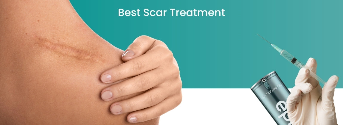 Top Scars Best Scar Treatment - 5 Top Methods Compared and Reviewed – Biodermis