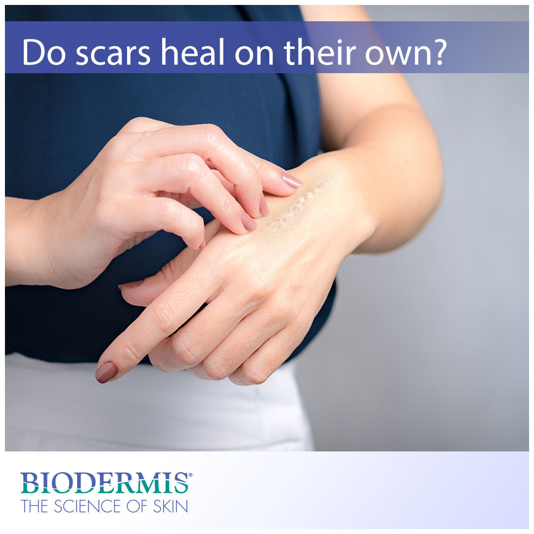 Can Scars Heal on Their Own? | Biodermis.com Biodermis