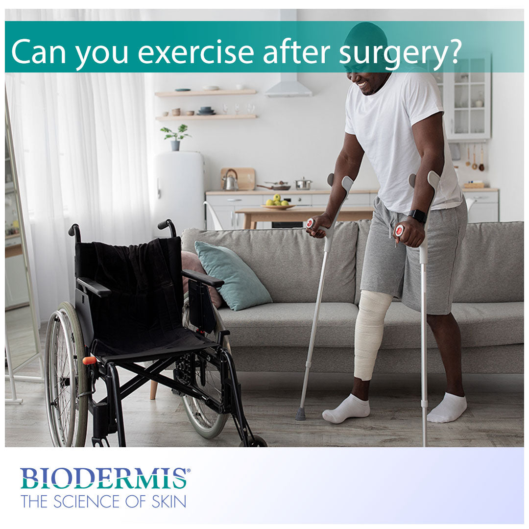 Can You Exercise After Surgery? | Biodermis.com Biodermis