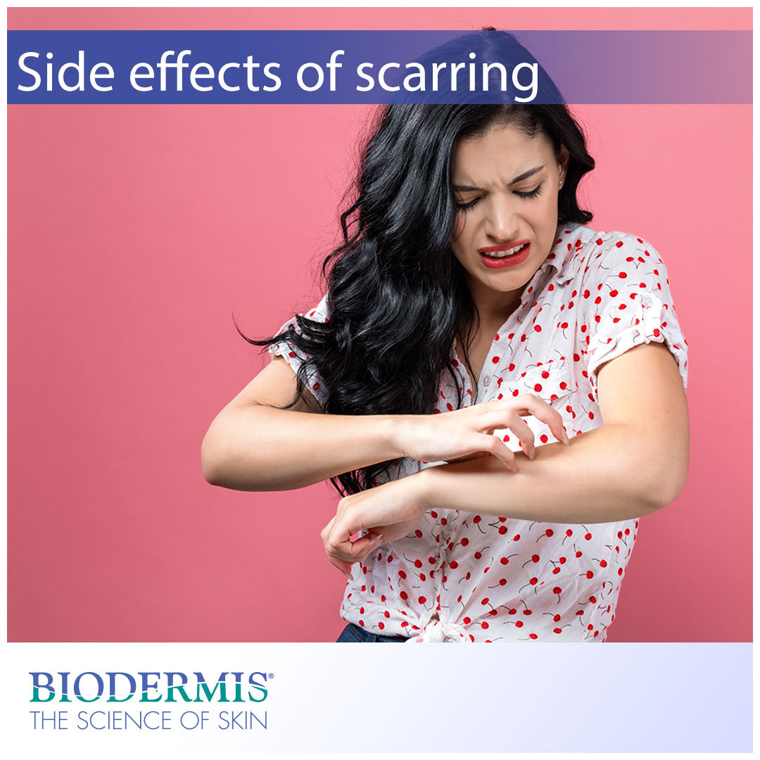 Common Side-Effects of Scarring |  Biodermis.com Biodermis