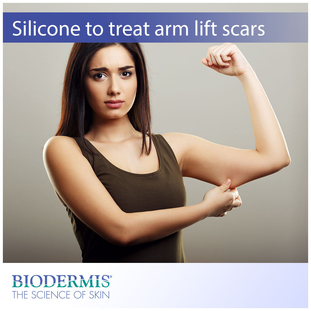 Cosmetic Surgery: How to Treat Scars after an Arm Lift |  Biodermis.com Biodermis