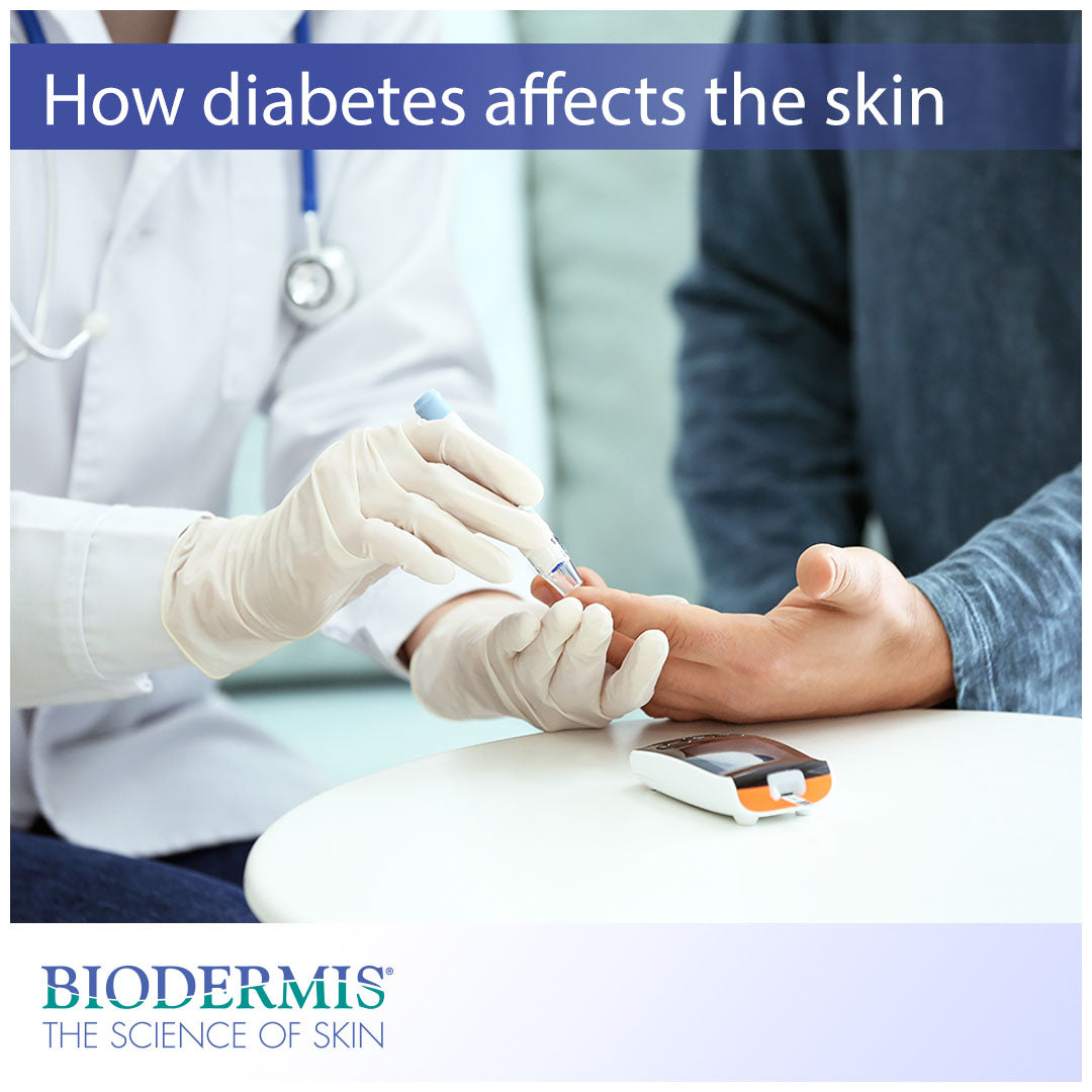 Diabetes-Related Skincare Problems |  Biodermis.com Biodermis