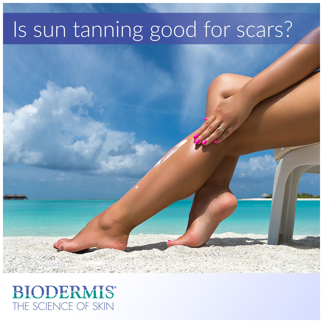 Does Tanning Improve the Appearance of Scars? |  Biodermis.com Biodermis