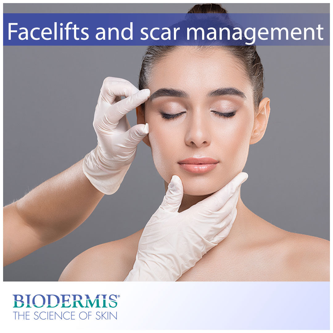 Face Lift Surgery and Scar Treatment | Biodermis.com Biodermis