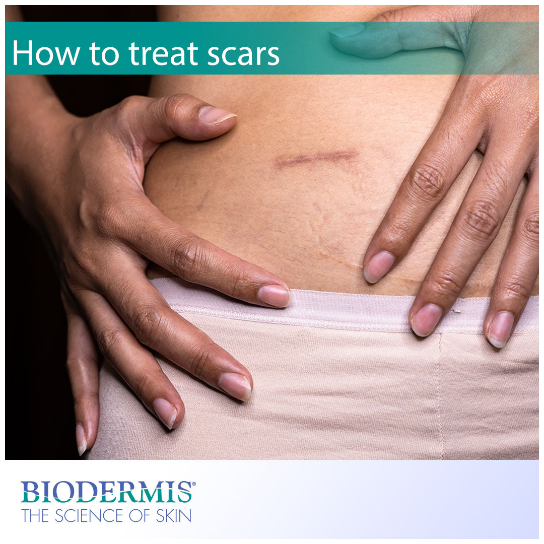 How Can Scars Be Treated?  |  Biodermis.com Biodermis