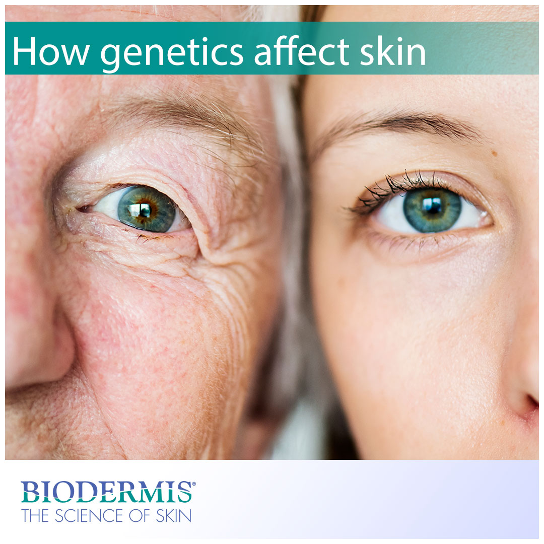 How Genetics Affects Your Skin | Biodermis.com Biodermis