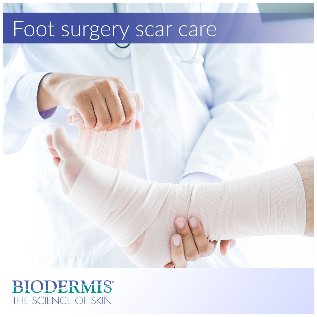 How to Care for Your Scars After Foot Surgery  |  Biodermis.com Biodermis