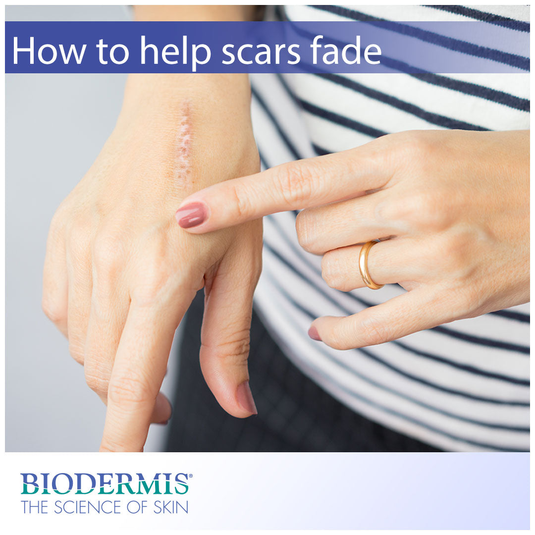 How to Help Scars Fade  |  Biodermis.com Biodermis