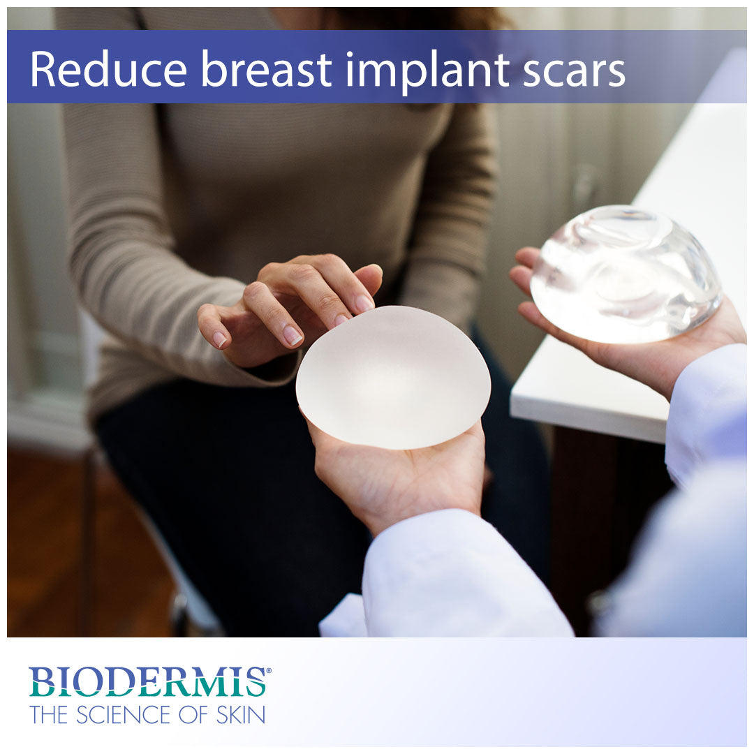 How to Reduce Scarring After Breast Implants  |  Biodermis.com Biodermis