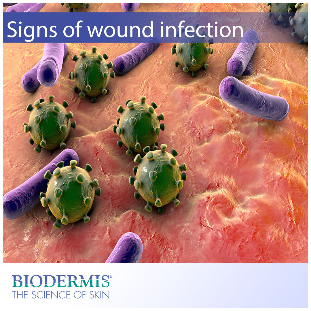 How to Tell if Your Wound is Infected  |  Biodermis.com Biodermis