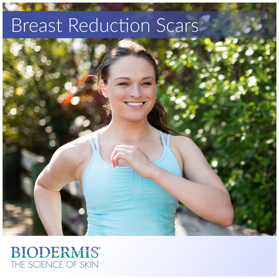 How to Treat Breast Reduction Scars | Biodermis.com Biodermis