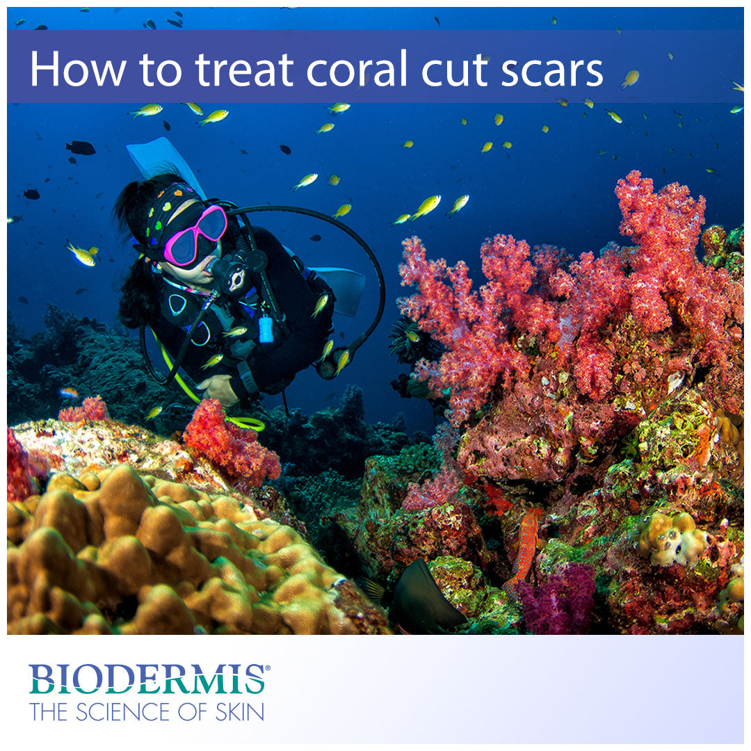 How to Treat Coral Cut Scars  |  Biodermis.com Biodermis