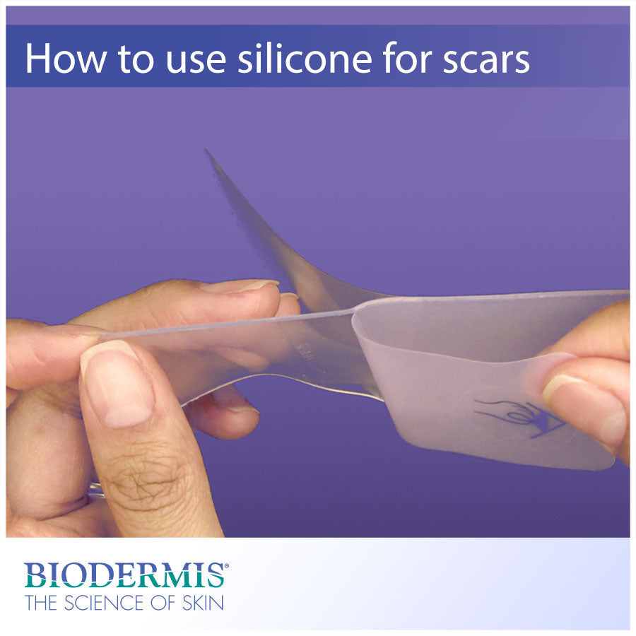 How to use Silicone Gel for Scars  |  Biodermis.com Biodermis