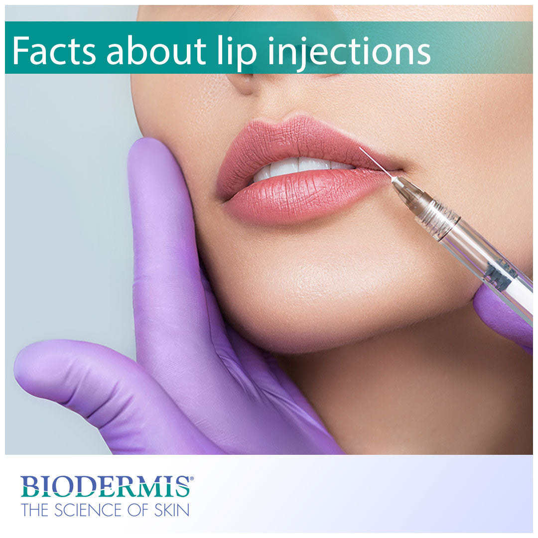Interesting Facts About Lip Injections | Biodermis.com Biodermis