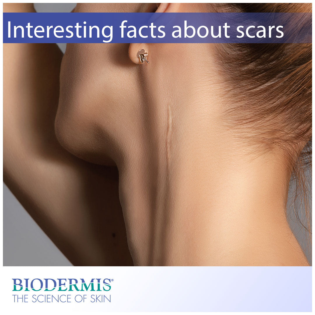 Interesting Facts About Scars | Biodermis.com Biodermis