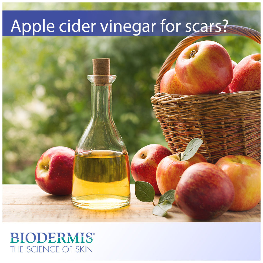 Is Apple Cider Vinegar Good for Scars? | Biodermis.com Biodermis