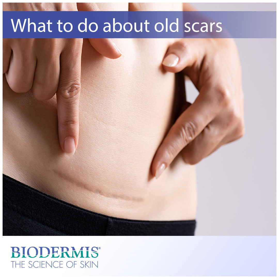 Is There Anything You Can Do About Old Scars?  |  Biodermis.com Biodermis