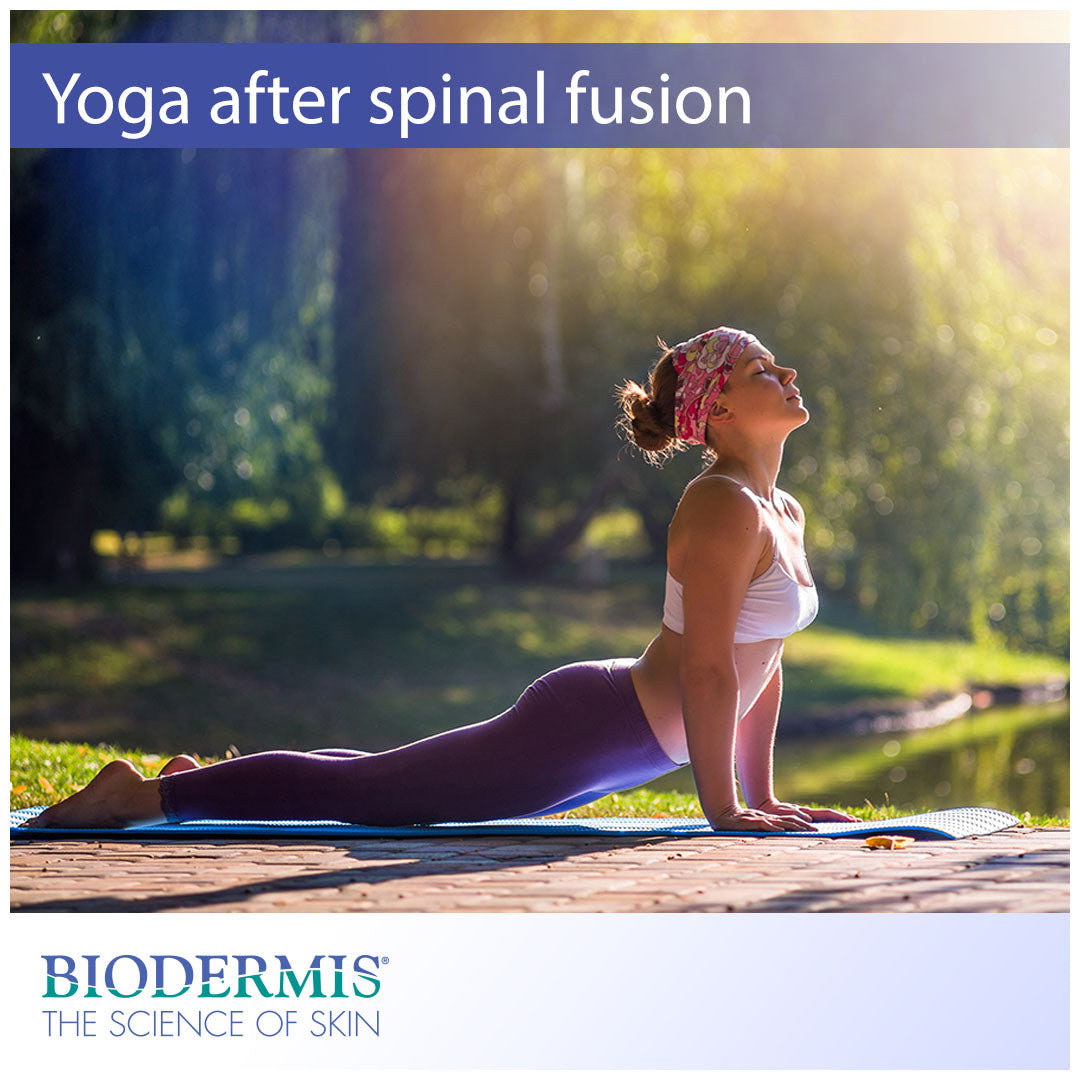 Is Yoga Beneficial after a Spinal Fusion Surgery?  |  Biodermis.com Biodermis