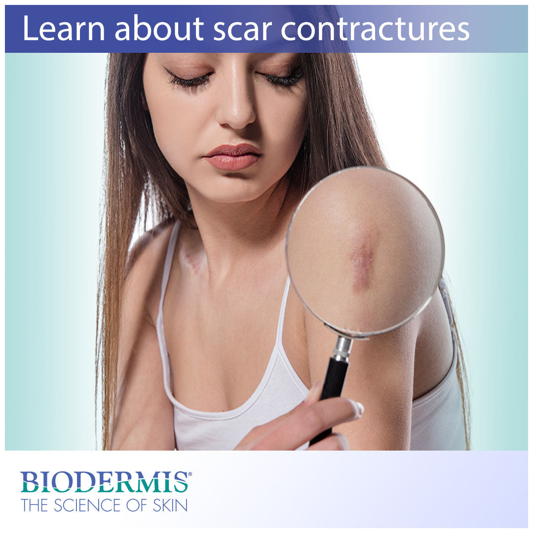 Learning about Scar Contractures and How to Treat Them  |  Biodermis.com Biodermis