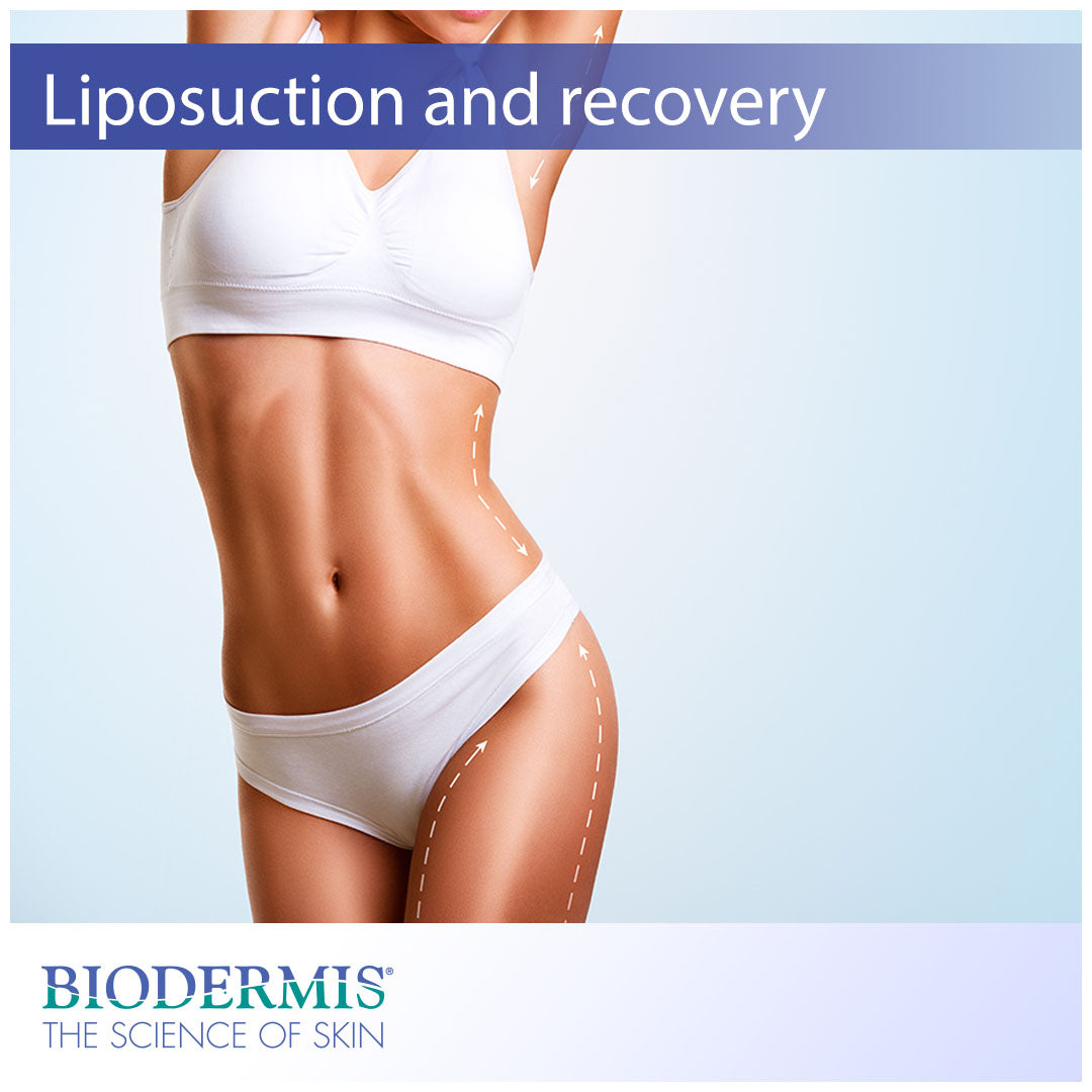 Liposuction and Post-Operative Recovery |  Biodermis.com Biodermis