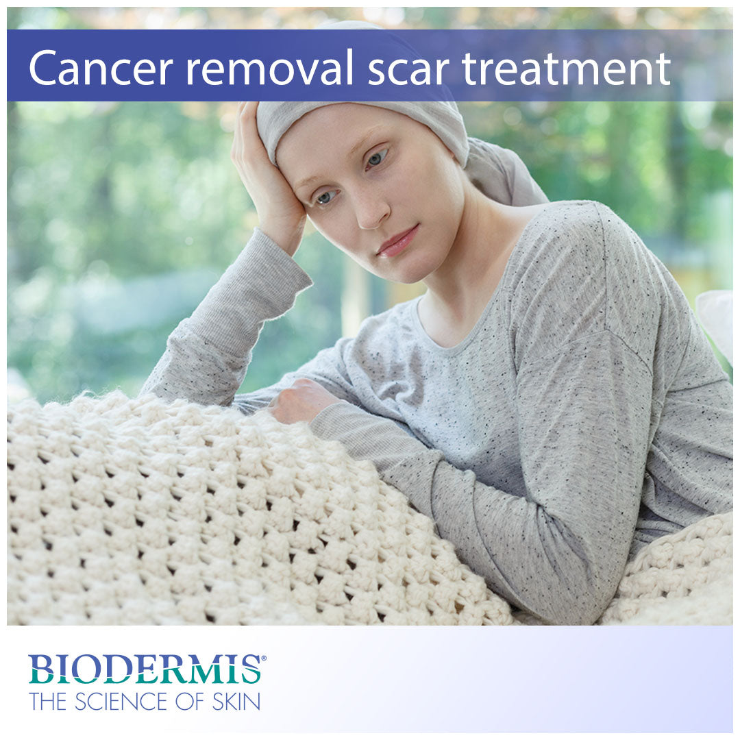 Scar Treatment After Cancer Removal Surgery |  Biodermis.com Biodermis