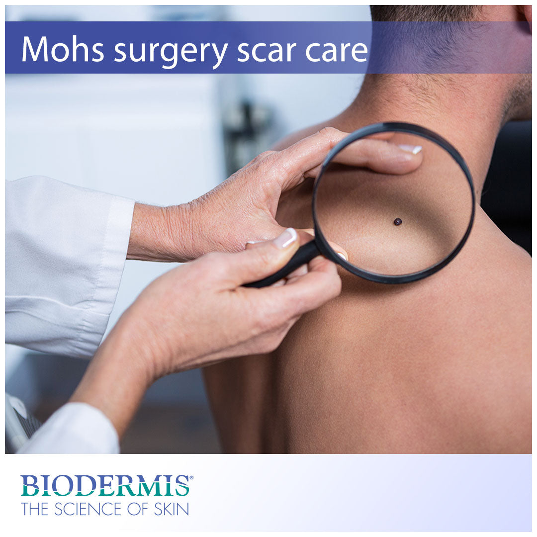 Scar Treatment for Mohs Surgery Patients |  Biodermis.com Biodermis