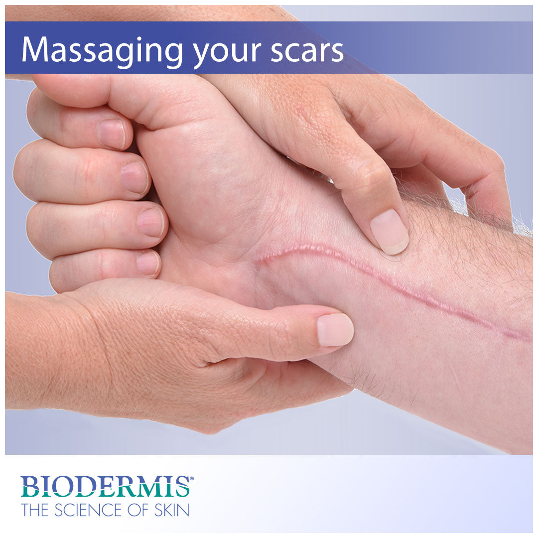 Should You Massage Your Scar?  |  Biodermis.com Biodermis