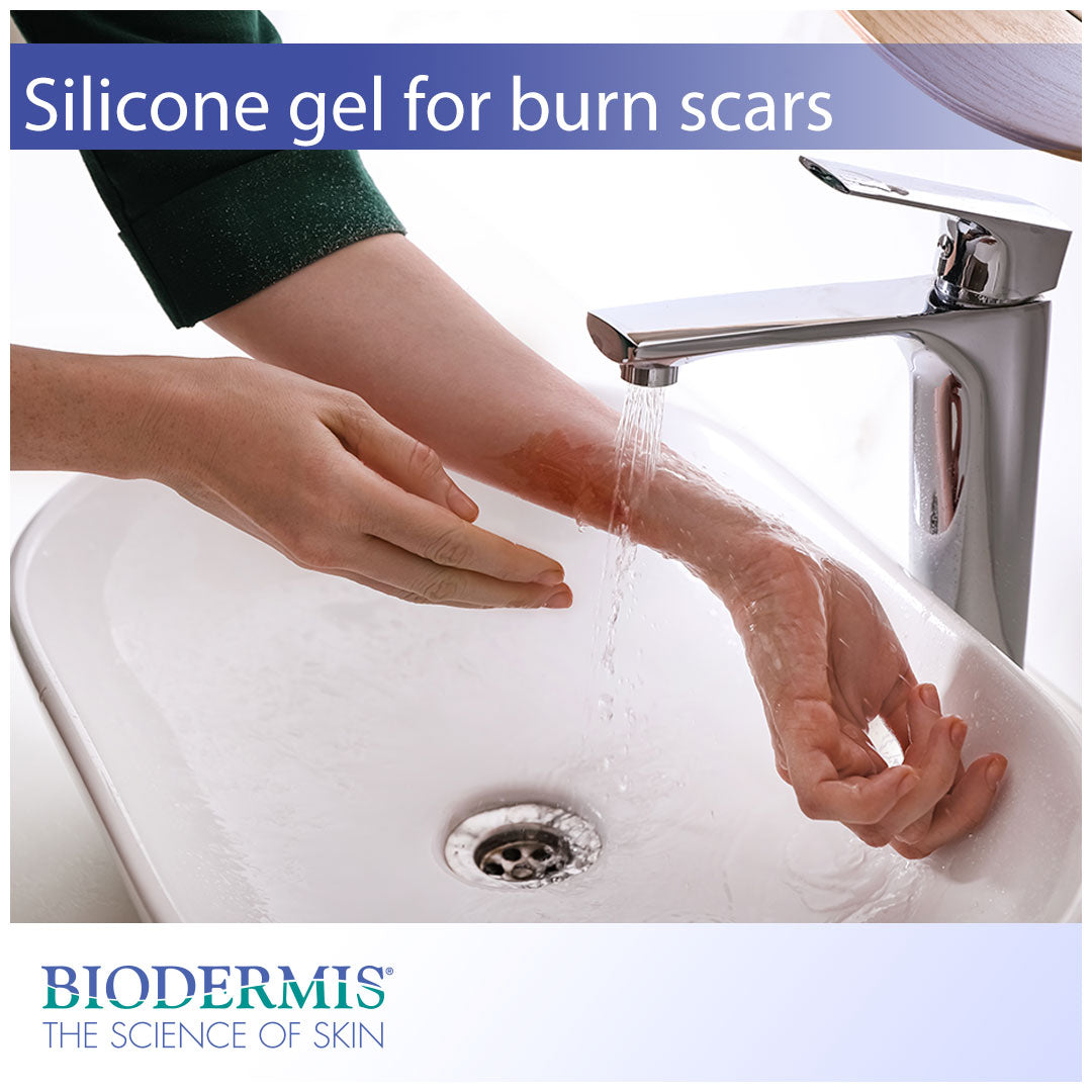 Silicone Gel for Burn Scars | Biodermis.com Biodermis