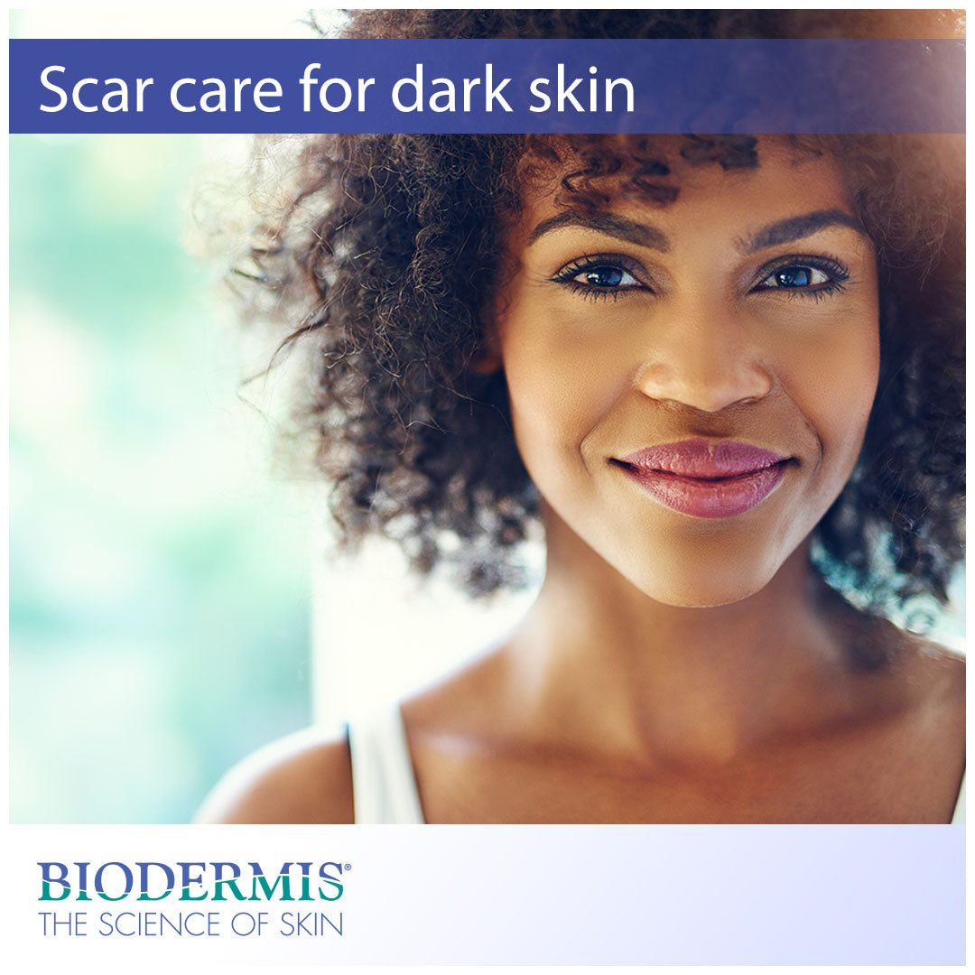 Skin Care Tips and Scar Treatment for People With Dark Skin |  Biodermis.com Biodermis