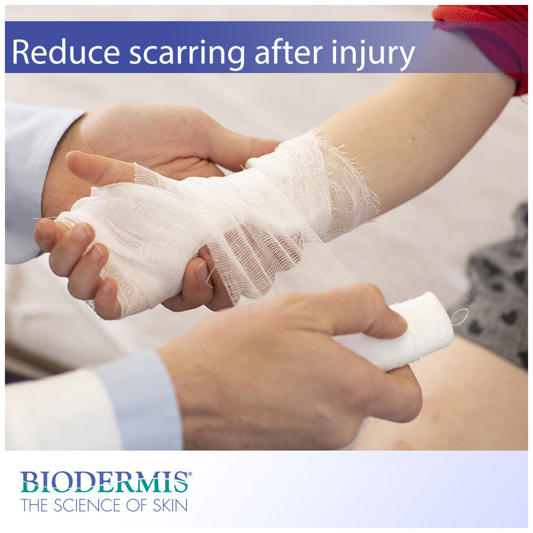 Steps to Reduce Scarring After Injury | Biodermis.com Biodermis