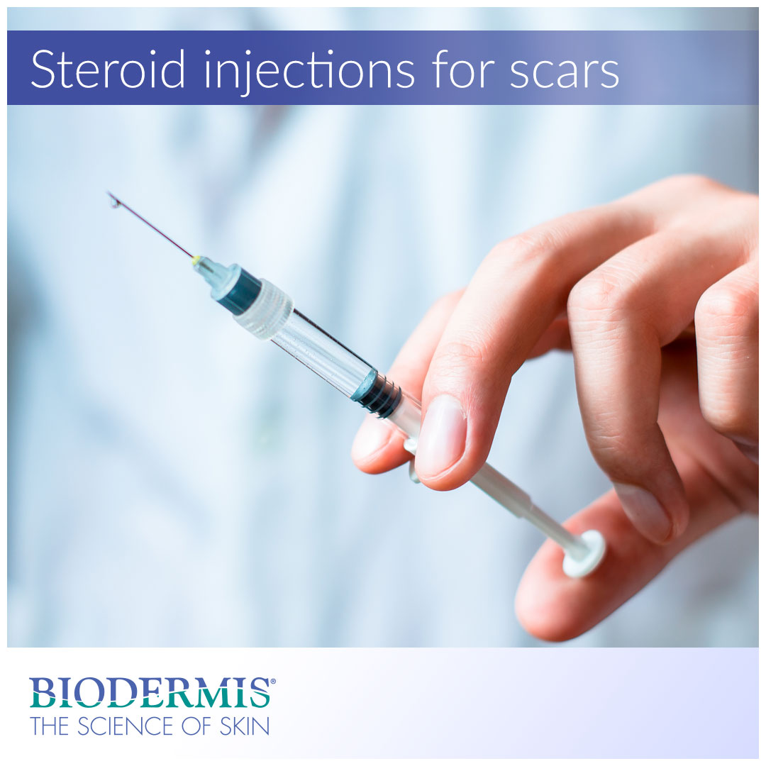 Steroid Injections for Raised Scars : What You Need to Know | Biodermis.com Biodermis