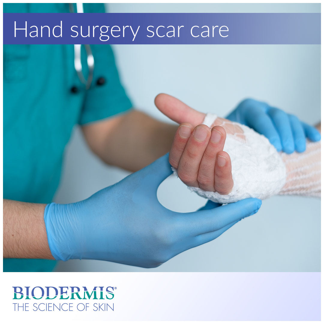 The Best Scar Treatment After Hand Surgery |  Biodermis.com Biodermis