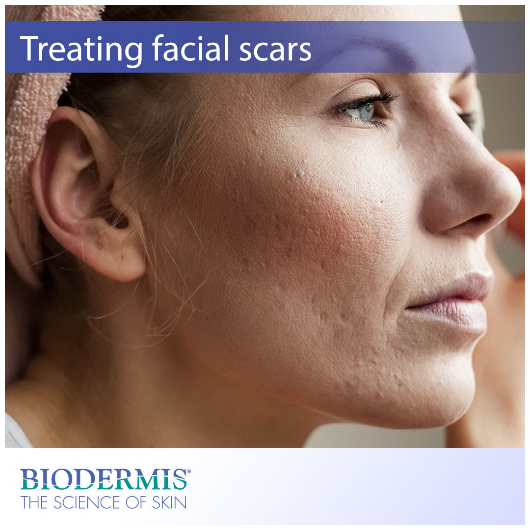 The Best Way to Treat Scars on Your Face  |  Biodermis.com Biodermis