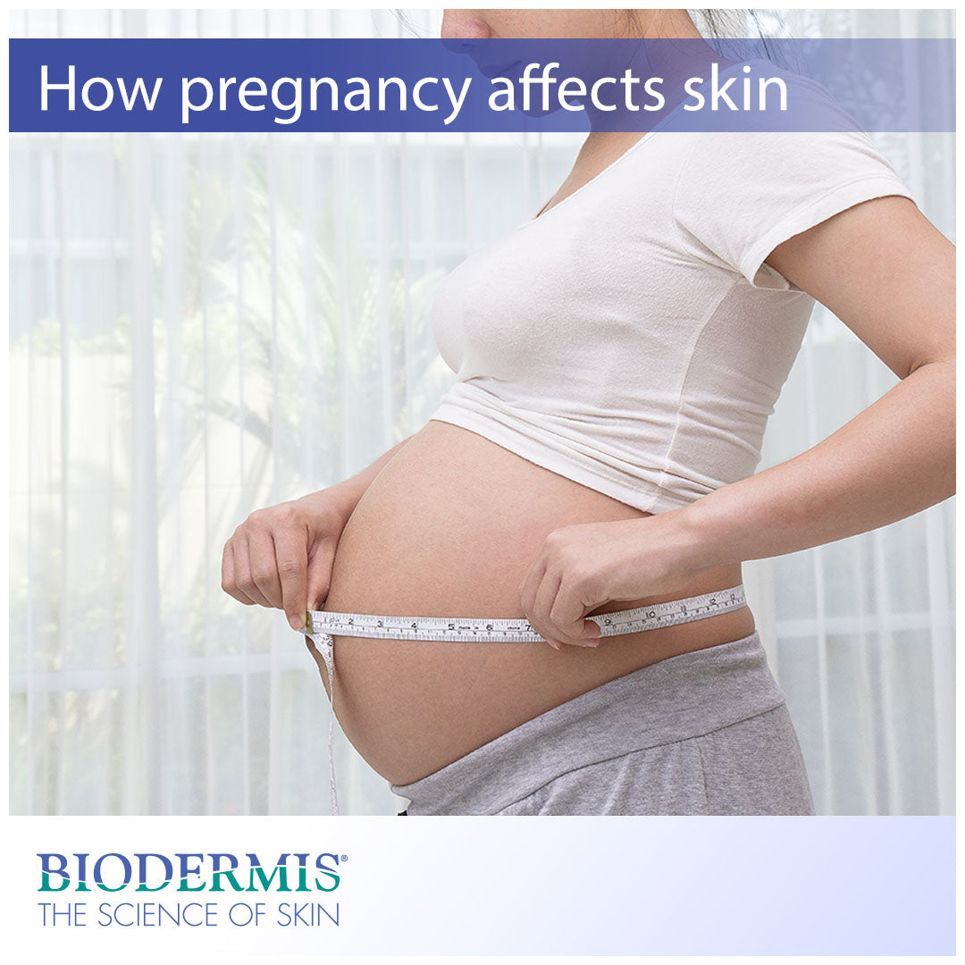 The Different Ways Pregnancy Can Change Your Skin |  Biodermis.com Biodermis