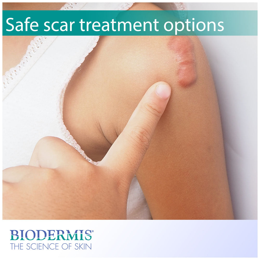The Safest Scar Treatment Options |  Biodermis.com Biodermis