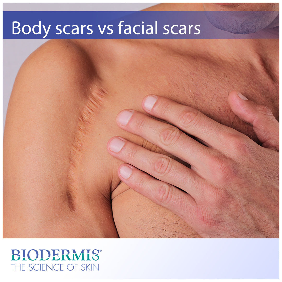 Treating Facial Scars Vs Body Scars | Biodermis.com Biodermis