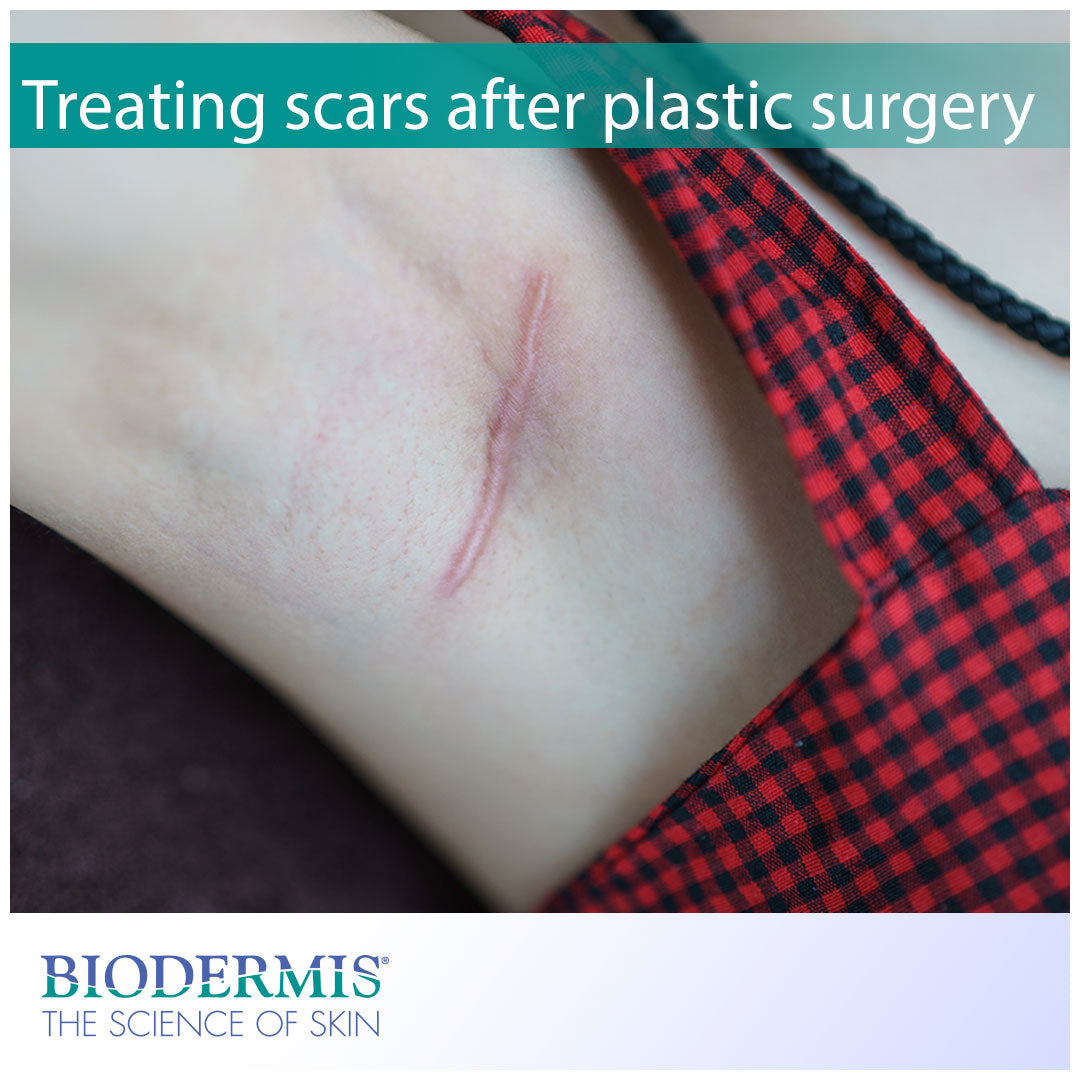 Treating Scars After Plastic Surgery | Biodermis.com Biodermis