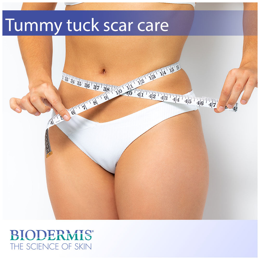 Treating Scars After a Tummy Tuck | Biodermis.com Biodermis