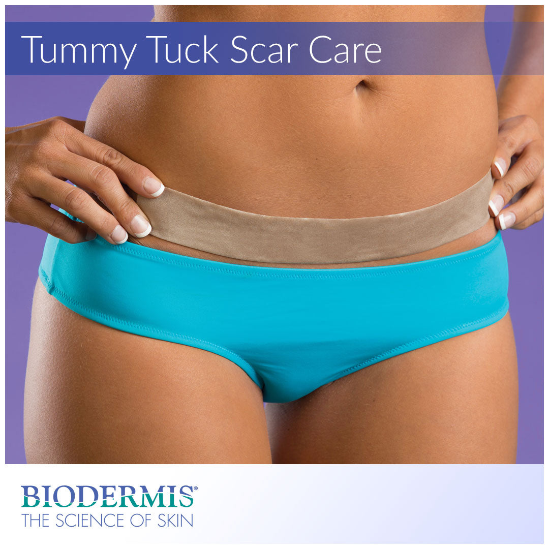Types of Tummy Tuck Procedures and Scar Care | Biodermis.com Biodermis
